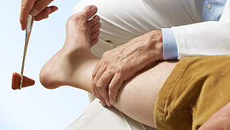 Príznaky periférnej polyneuropatie: reflexy nefungujú správne a pacienti cítia slabosť v nohách.