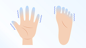 Príznaky polyneuropatie nôh a rúk: slabosť a znížená citlivosť
