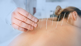 Akupunktúra – alternatívna liečba bolesti po operácii