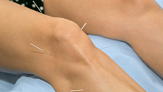 Artróza kolena alternatívna liečba