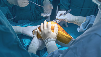 Operácia kolena totálna endoprotéza