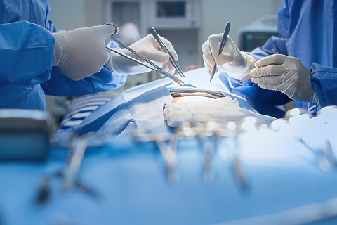 Pri operácii sa využívajú rôzne nástroje a operačné techniky