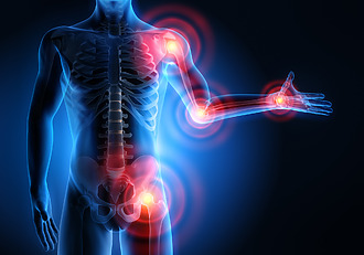 Reumatoidný zápal môže postihovať rôzne kĺby v tele.