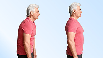 Správne držanie tela je súčasťou prevencie artrózy chrbtice