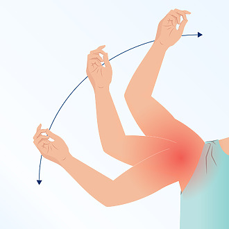 Bolesť a obmedzenie pohybu pri zamrznutom ramene